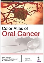 کتاب کالر اطلس آف اورال کانسر Color Atlas of Oral Cancer