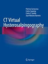 کتاب سی تی ویرچوال هیستروسالپنگوگرافی CT Virtual Hysterosalpingography2014