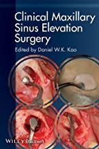 کتاب کلینیکال مکسیلیری سینوس الویشن سرجری Clinical Maxillary Sinus Elevation Surgery 1st Edition2014