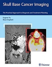 کتاب اسکال بیس کانسر ایمیجینگ Skull Base Cancer Imaging: The Practical Approach to Diagnosis and Treatment Planning2017