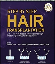 کتاب استپ بای استپ هیر ترنس پلانتیشن Step by Step Hair Transplantation 2019