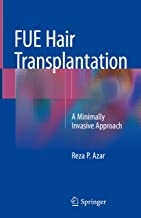 کتاب فیو هیر ترانس پلانتیشن Fue Hair Transplantation : A Minimally Invasive Approach