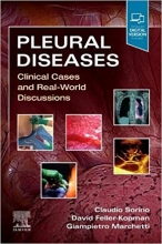 کتاب پلیورال دیزیس کلینیکال کیسز اند ریل ورد دیسکازیشن Pleural Diseases: Clinical Cases and Real-World Discussions - Videos