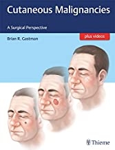 کتاب کوتینیوس مالیگنانسیز Cutaneous Malignancies: A Surgical Perspective2017