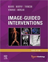 کتاب ایمیج گاید اینترونشنز اکسپرت رادیولوژی سریز Image-Guided Interventions E-Book: Expert Radiology Series, 3rd Edition - Video