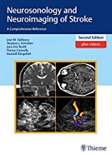 کتاب نوروسونولوژی اند نوروایمیجینگ آف استروک Neurosonology and Neuroimaging of Stroke, 2nd Edition2017