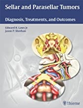 کتاب سلار و پاراسلار تومورز Sellar and Parasellar Tumors: Diagnosis, Treatments, and Outcomes2011