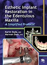 کتاب استتیک ایمپلنت رستوریشن Esthetic Implant Restoration in the Edentulous Maxilla2014
