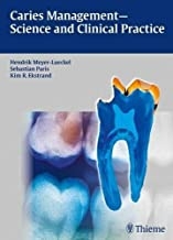 کتاب کیریز منیجمنت Caries Management – Science and Clinical Practice 1st Edition2020