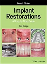 کتاب ایمپلنت رستوریشنز Implant Restorations: A Step-by-Step Guide 4th Edition, Kindle Edition 2020