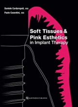 کتاب سافت تیشوز اند پینک استتیکس این ایمپلنت تراپی Soft Tissues and Pink Esthetics in Implant Therapy 1st Edition 2020