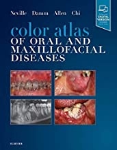کتاب کالر اطلس آف اورال اند مکسیل اوفیشال دیزیزز Color Atlas of Oral and Maxillofacial Diseases