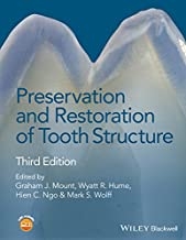 کتاب پریزرویشن اند رستوریشن Preservation and Restoration of Tooth Structure 2016