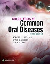 کتاب کالر اطلس آف کامن اورال دیزیز Color Atlas of Common Oral Diseases
