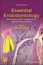 کتاب اسنشال اندودنتولوژی Essential Endodontology : Prevention and Treatment of Apical Periodontitis