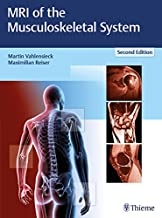کتاب ام آر آی آف ماسکلواسکلتال سیستم MRI of the Musculoskeletal System, 2nd Edition2018