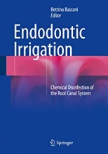 کتاب اندودنتیک ایریگیشن Endodontic Irrigation: Chemical disinfection of the root canal system2015