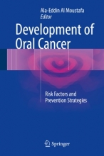 کتاب دولاپمنت آف اورال کنسر Development of Oral Cancer : Risk Factors and Prevention Strategies
