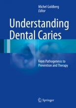 کتاب آندرستندینگ دنتال کریرز Understanding Dental Caries : From Pathogenesis to Prevention and Therapy