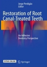 کتاب رستوریشن آف روت کانال تریتد تث Restoration of Root Canal-Treated Teeth : An Adhesive Dentistry Perspective