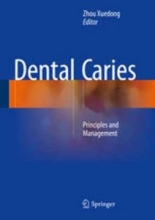 کتاب دنتال کریرز Dental Caries : Principles and Management