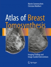 کتاب اطلس آف بریست توموسینتسیز Atlas of Breast Tomosynthesis : Imaging Findings and Image-Guided Interventions