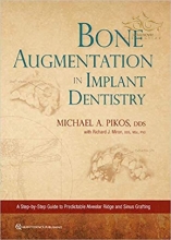 کتاب زبان بون اوگمنتیشن این ایمپلنت دنتیستری Bone Augmentation in Implant Dentistry: A Step-by-Step Guide to Predictable Alveola