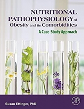 کتاب نیوتریشن پاتوفیزیولوژی Nutritional Pathophysiology of Obesity and its Comorbidities A Case-Study Approach