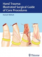کتاب هند تروما Hand Trauma: Illustrated Surgical Guide of Core Procedures