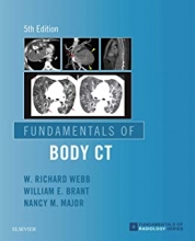 کتاب فاندامنتالز آف بادی سی تی Fundamentals of Body CT (Fundamentals of Radiology) 5th Edition