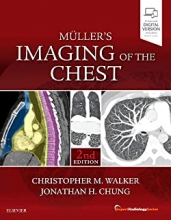 کتاب مولر ایمیجینگ آف د چست Muller’s Imaging of the Chest, 2nd Edition2018