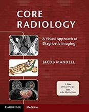 کتاب کور رادیولوژی Core Radiology: A Visual Approach to Diagnostic Imaging 1st Edition 2013