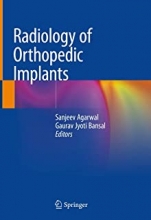 کتاب رادیولوژی آف اورتوپدیک ایمپلنت Radiology of Orthopedic Implants
