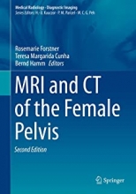 کتاب ام آی آر اند سی تی MRI and CT of the Female Pelvis