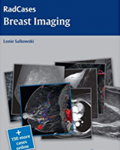کتاب رادکیسز بریست ایمیجینگ Radcases Breast Imaging