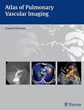 کتاب اطلس آف پالمونری Atlas of Pulmonary Vascular Imaging