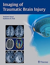 کتاب ایمیجینگ آف تروماتیک برین اینجوری Imaging of Traumatic Brain Injury