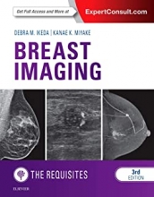 کتاب بریست ایمیجینگ Breast Imaging: The Requisites