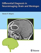 کتاب دیفرنشال دیاگنوسیس این نوروایمیجینگ Differential Diagnosis in Neuroimaging: Brain and Meninges
