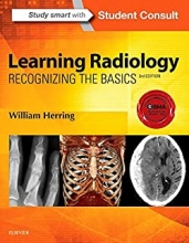 کتاب لرنینگ رادیولوژی Learning Radiology: Recognizing the Basics