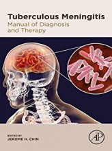 کتاب توبرکیولوس مننژیت Tuberculous Meningitis : Manual of Diagnosis and Therapy
