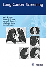 کتاب لانگ کنسر اسکرینینگ Lung Cancer Screening 1st Edition2017