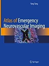 کتاب اطلس آف ایمرجنسی نیوروواسکولار ایمیجینگ Atlas of Emergency Neurovascular Imaging2020