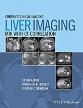 کتاب لیور ایمیجینگ Liver Imaging: MRI with CT Correlation (Current Clinical Imaging)2015