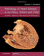 کتاب پاتولوژی آف هارت دیزیز 2019 Pathology of Heart Disease in the Fetus, Infant and Child: Autopsy, Surgical and Molecular Path