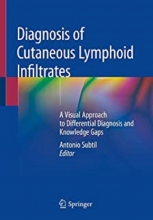 کتاب دایگنوسیس آف کیوتینیوس Diagnosis of Cutaneous Lymphoid Infiltrates 1st Edition2019