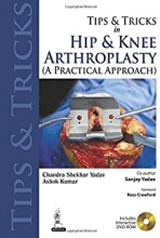 کتاب تیپس اند تریکس Tips and Tricks in Hip and Knee Arthroplasty : (A Practical Approach)