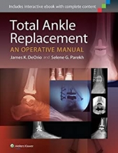 کتاب توتال آنکل ریپلیسمنت Total Ankle Replacement: An Operative Manual