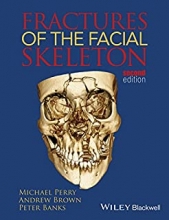 کتاب فرکچرز آف د فیشال اسکلتون Fractures of the Facial Skeleton 2nd Edition