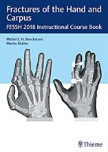 کتاب فرکچرز آف د هند اند کارپوس Fractures of the Hand and Carpus: FESSH 2018 Instructional Course Book 1st Edition, Kindle Editi